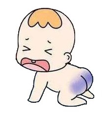 <strong>孩子胎记怎么去除更有效？南京哪家胎记医院效果好？</strong>