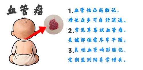 各类血管瘤高清图片，普通人怎么辨别？